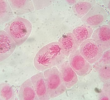 Solved mitosis experiment, stained chromosome of the onion | Chegg.com