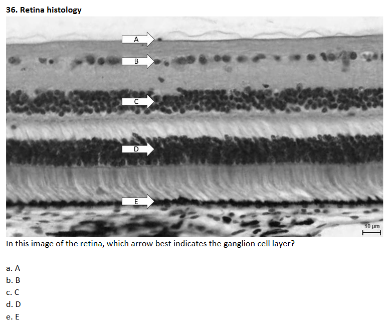 Solved 36. Retina histology A B C D E In this image of the | Chegg.com