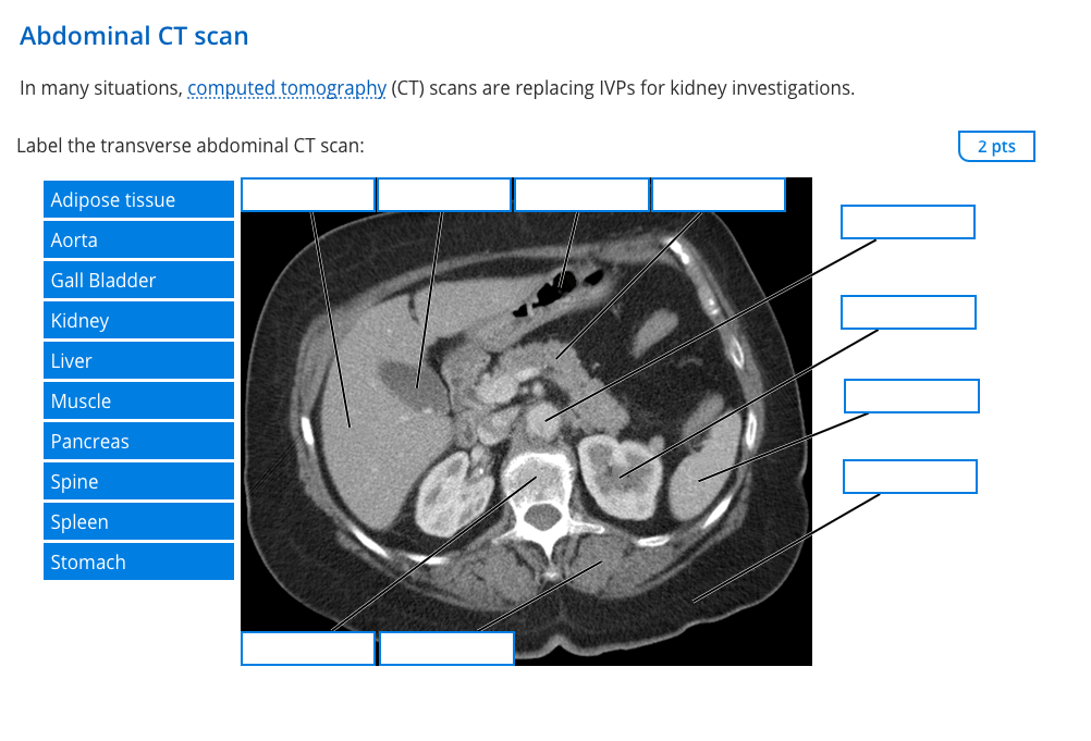 Solved Abdominal CT scan In many situations, computed | Chegg.com