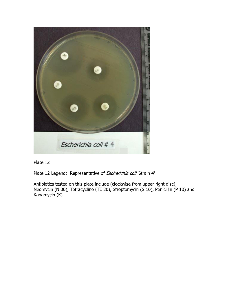 Solved lom Escherichia coli 4 uto Plate 12 Plate 12 Chegg