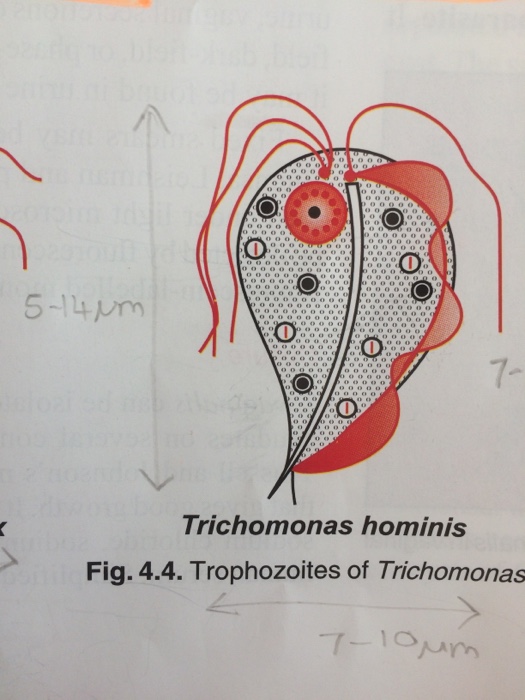 trichomonas hominis
