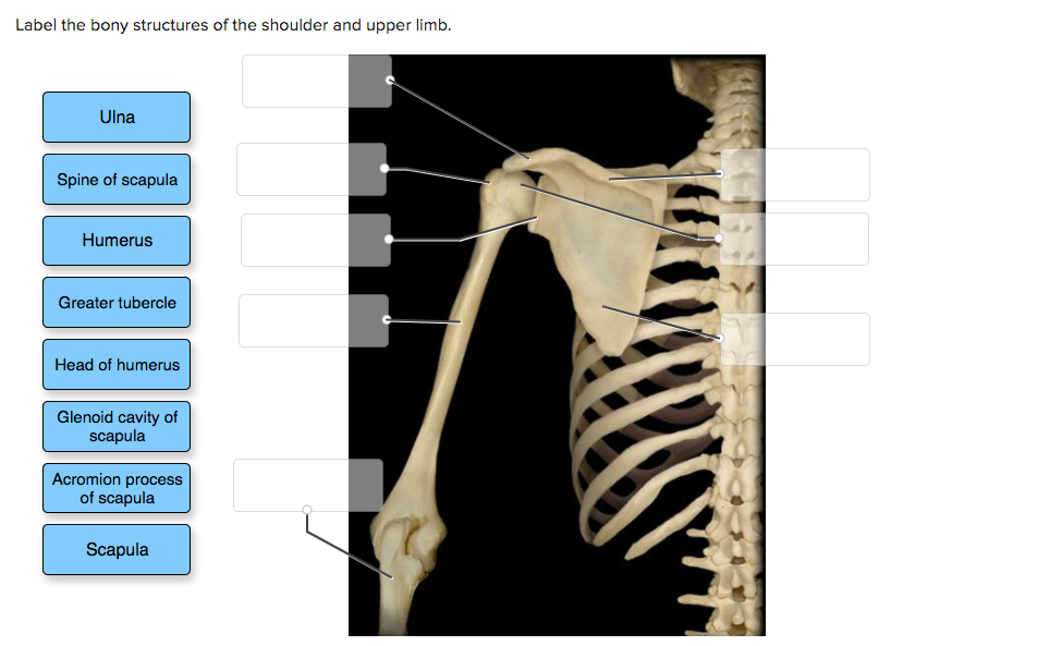 Solved Label the bony structures of the shoulder and upper | Chegg.com