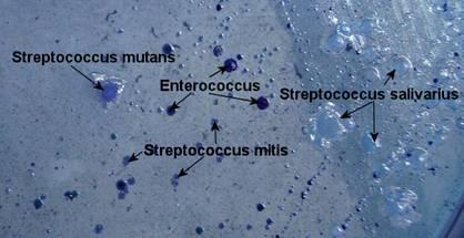 streptococcus salivarius morphology