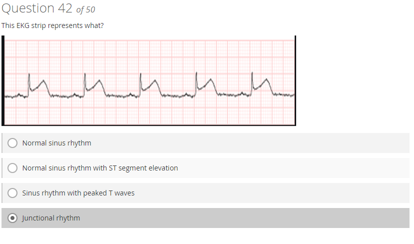 st segment elevation strip