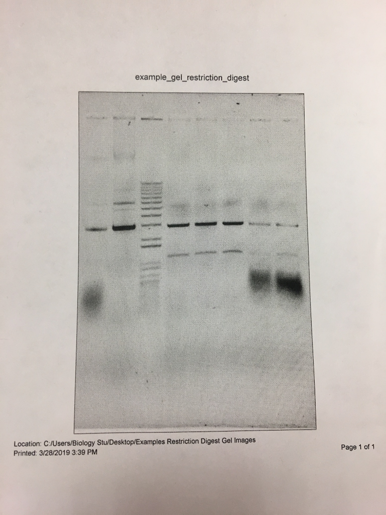 LAB REPORT RESTRICTION ENDONUCLEASE DIGESTION OF A