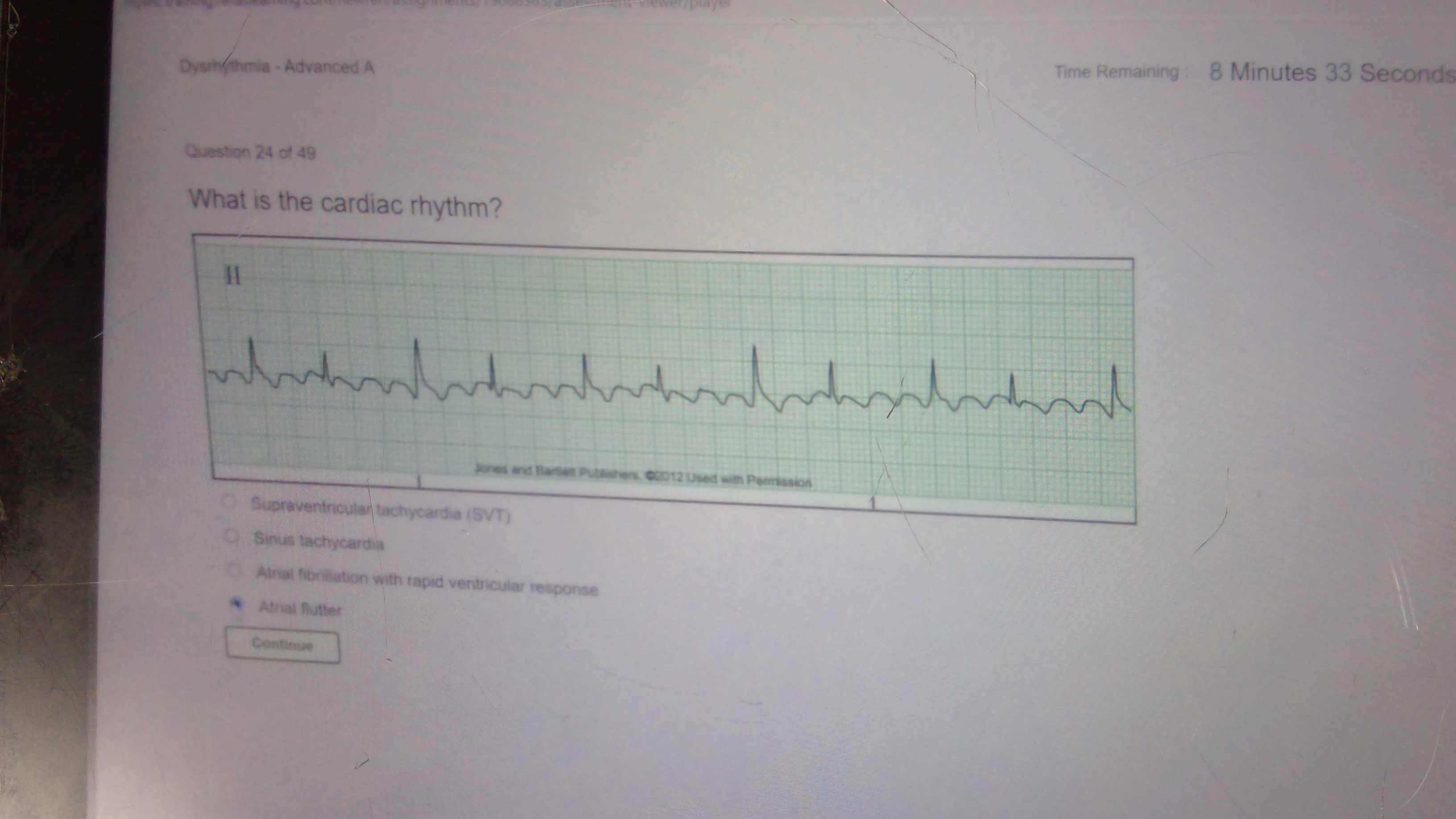 Solved Question 24 of 49 What is the cardiac rhythm? | Chegg.com