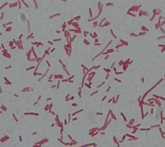 Solved receiving the Gram stain -interpreting the Gram stain | Chegg.com