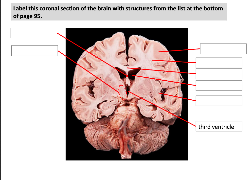 coronal brain