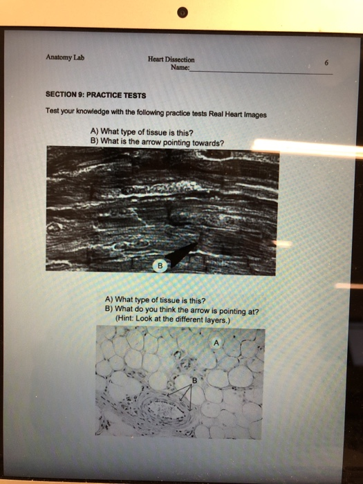 Solved Heart Dissection Anatomy Lab Name SECTION 9