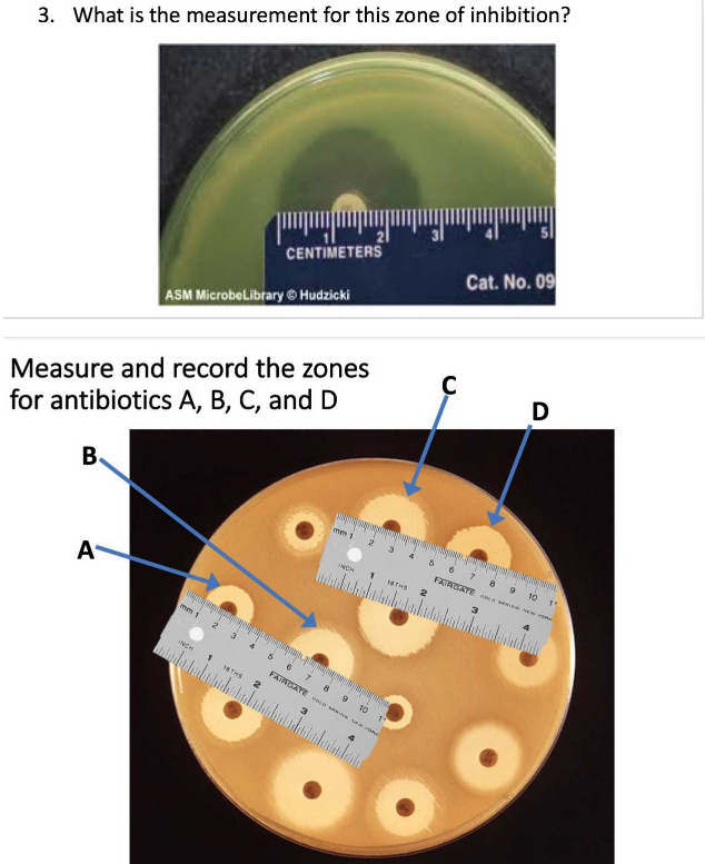 How To Measure Zones Of Inhibition