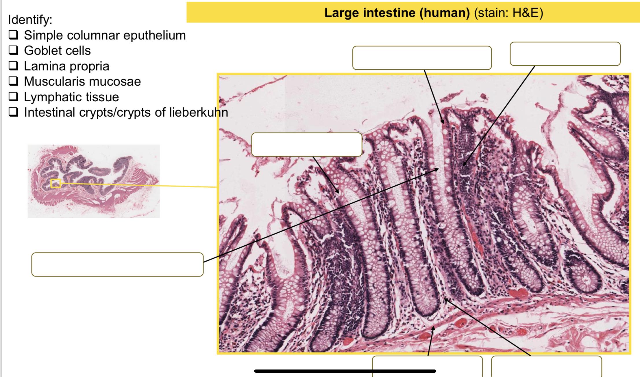 Solved Large intestine (human) (stain: H\&E)Small intestine | Chegg.com