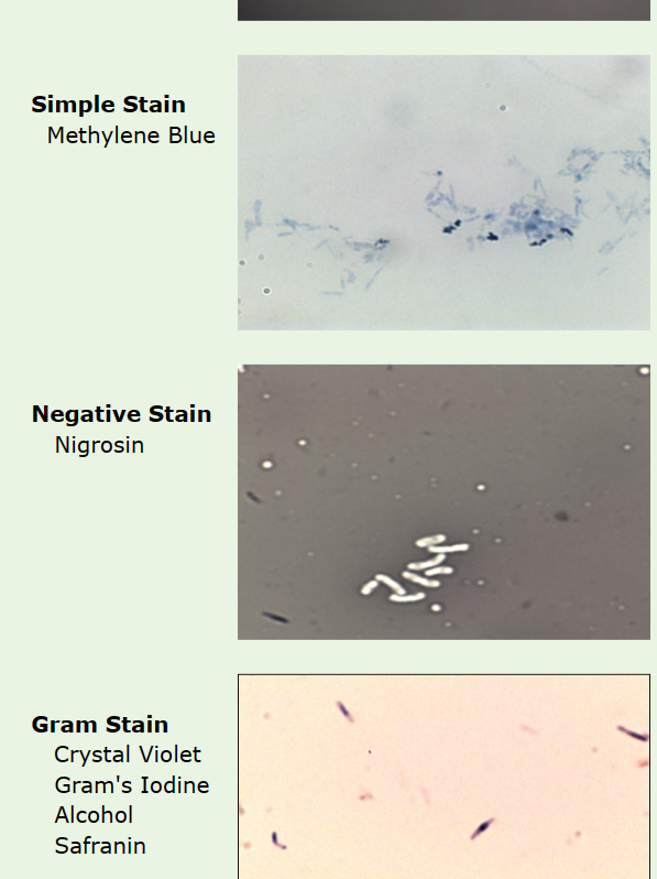 Solved Simple Stain Methylene Blue Negative Stain Nigrosin | Chegg.com