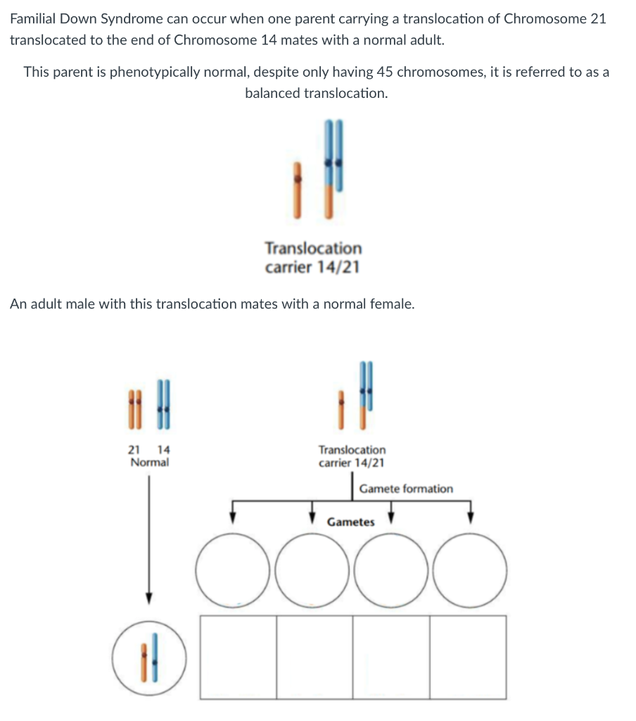 down syndrome diagram