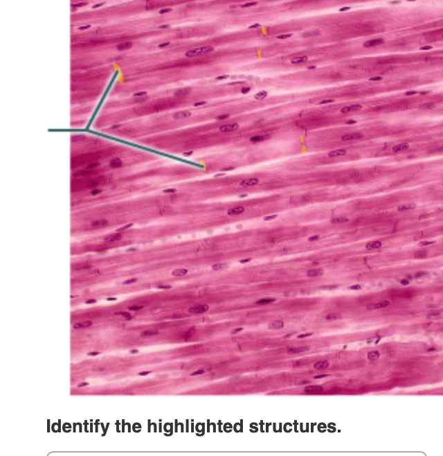 Solved Identify the highlighted structures. | Chegg.com