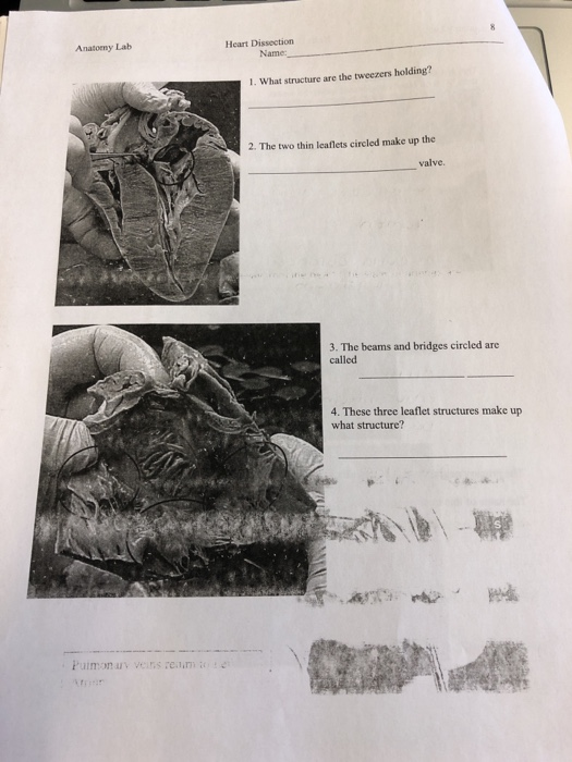 Solved Anatoeny Lab Heart Dissection Name . What structure