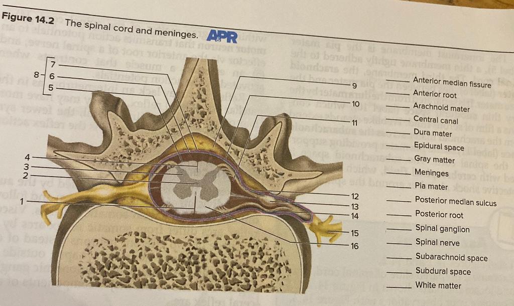 Solved Figure 14.2 The spinal cord and meninges. Anterior | Chegg.com