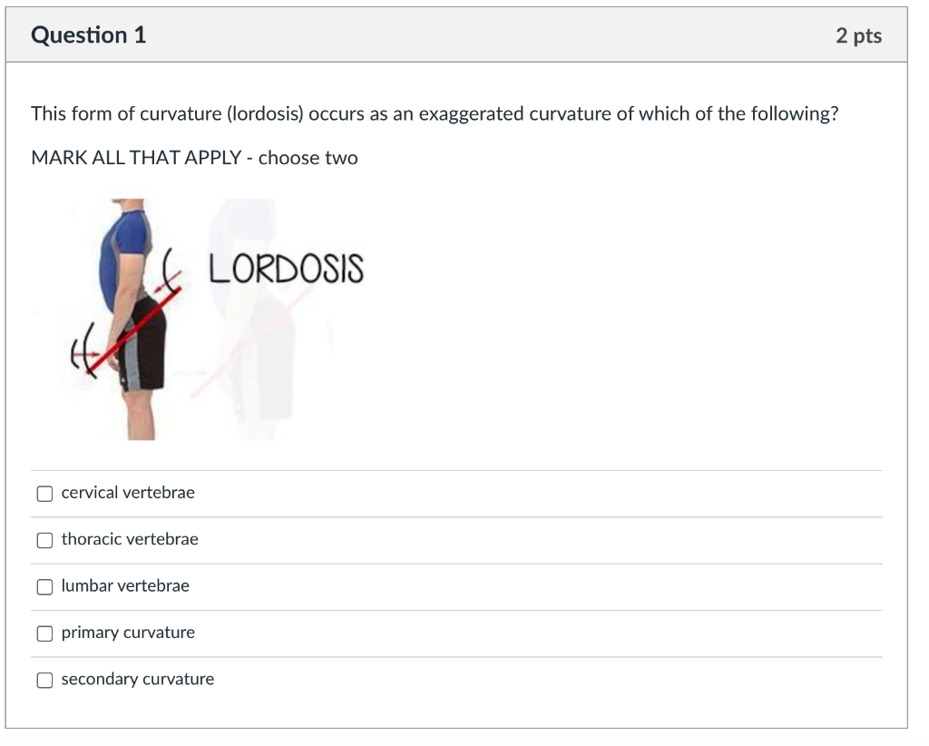 Solved Question 1 2 pts This form of curvature (lordosis)