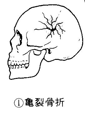 柔整総論１ Flashcards Chegg Com