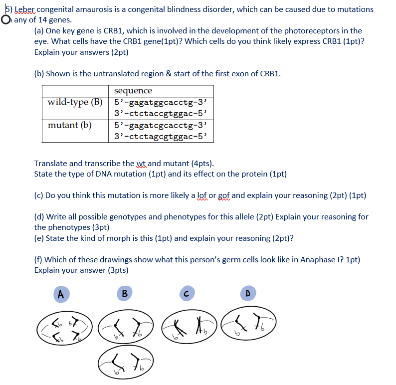 5) Leber congenital amaurosis is a congenital