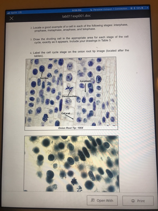 Observation Of Mitosis In A Plant Cell