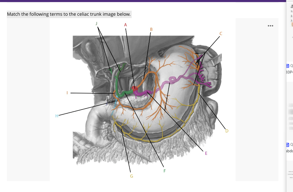 Solved Options Are: Splenic Artery Right Gastric | Chegg.com