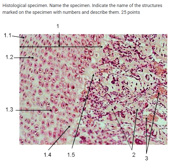 Histological specimen. Name the specimen. Indicate