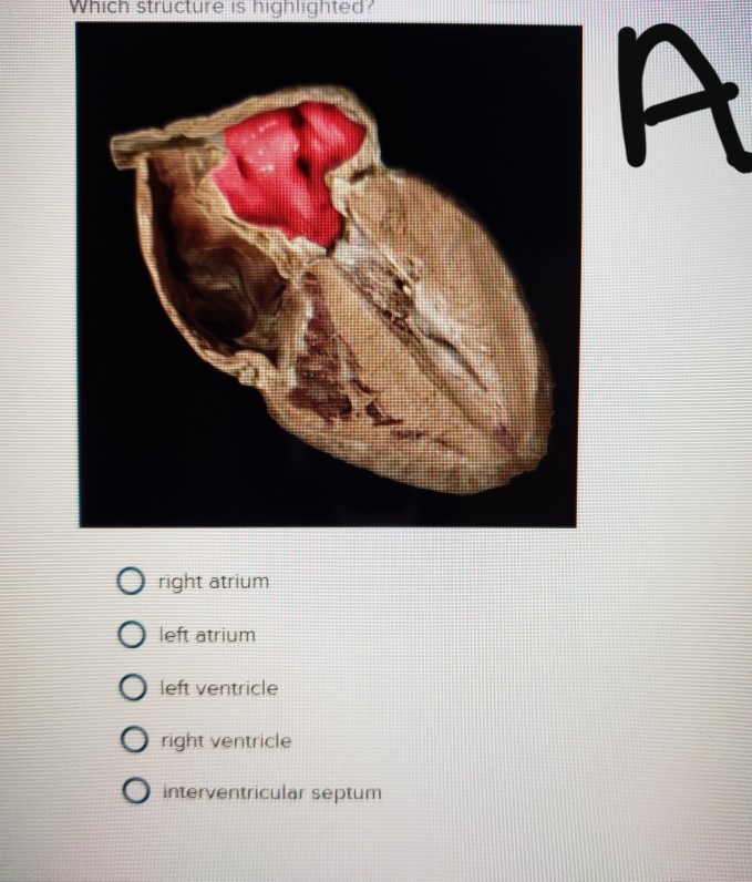 solved-which-structure-is-highlighted-right-atrium-left-chegg