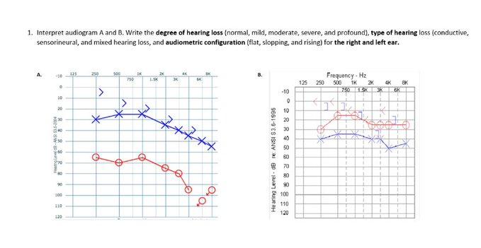 conductive hearing loss diagram