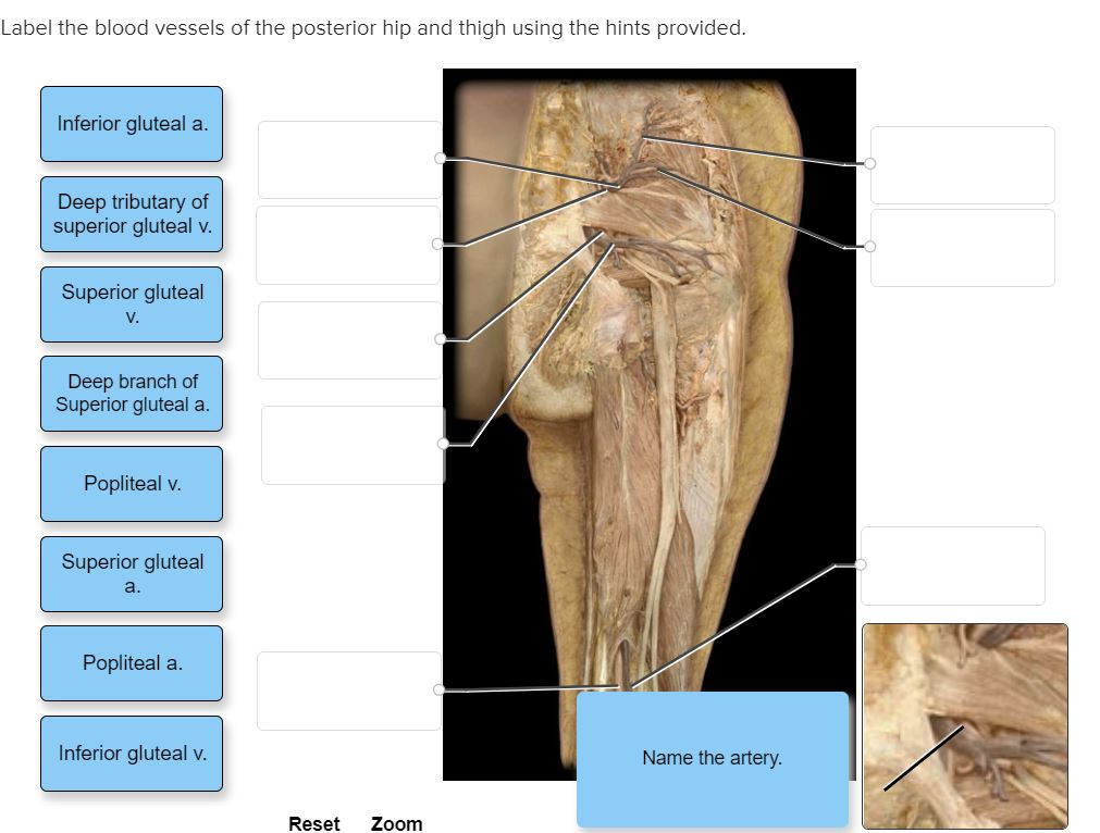 Solved Label the blood vessels of the posterior hip and | Chegg.com