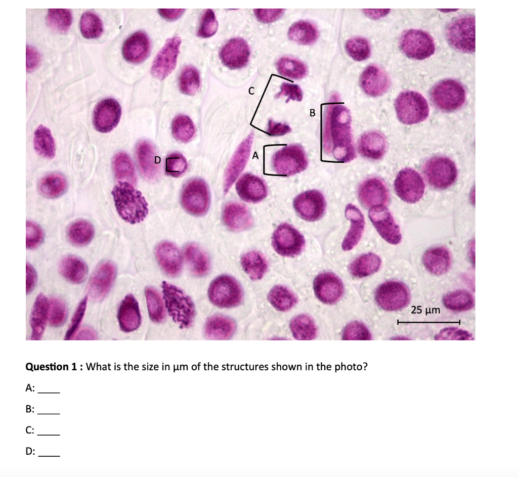 Solved Knowing that this image shows 125um from left to | Chegg.com