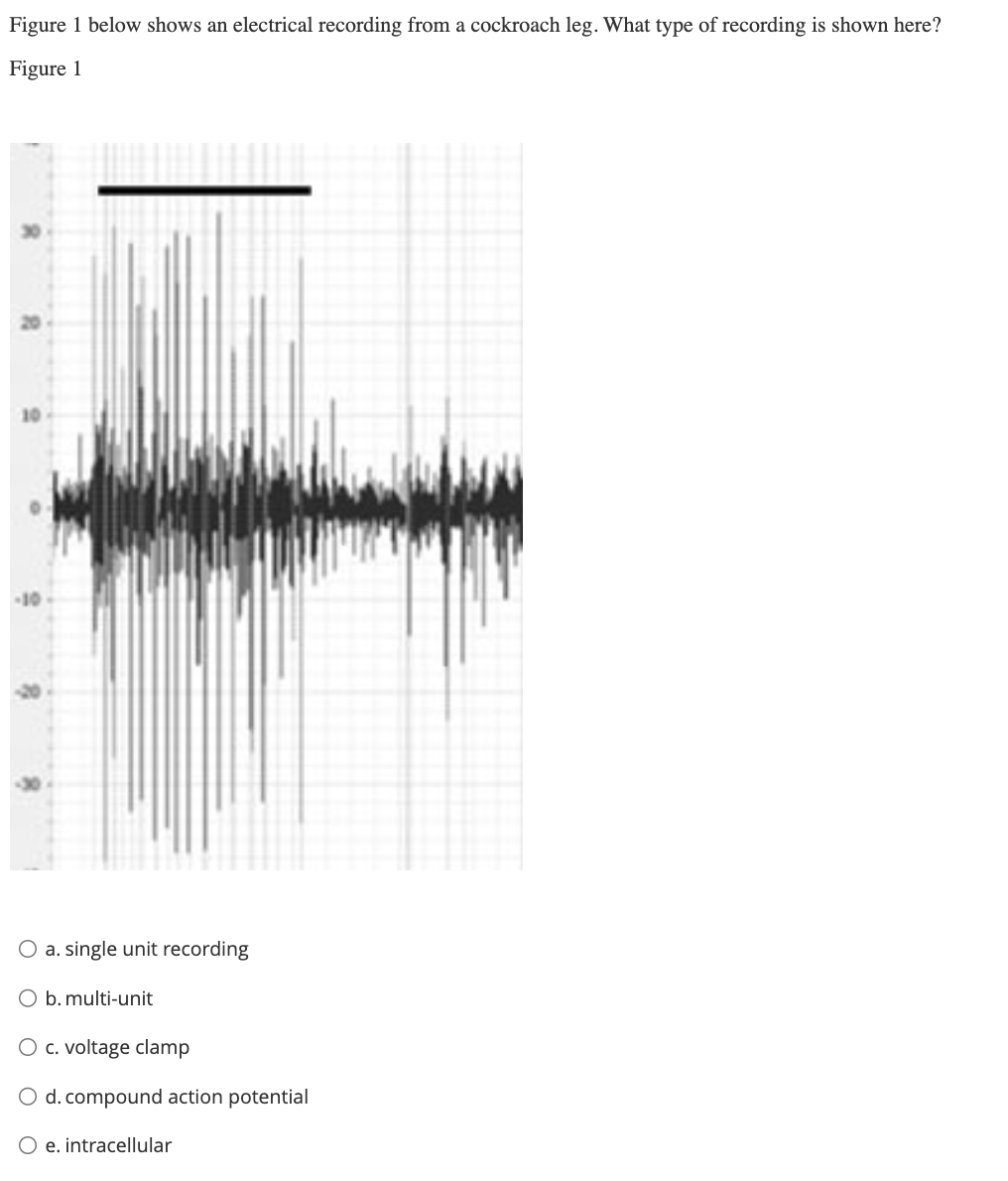 Solved Figure 1 below shows an electrical recording from a