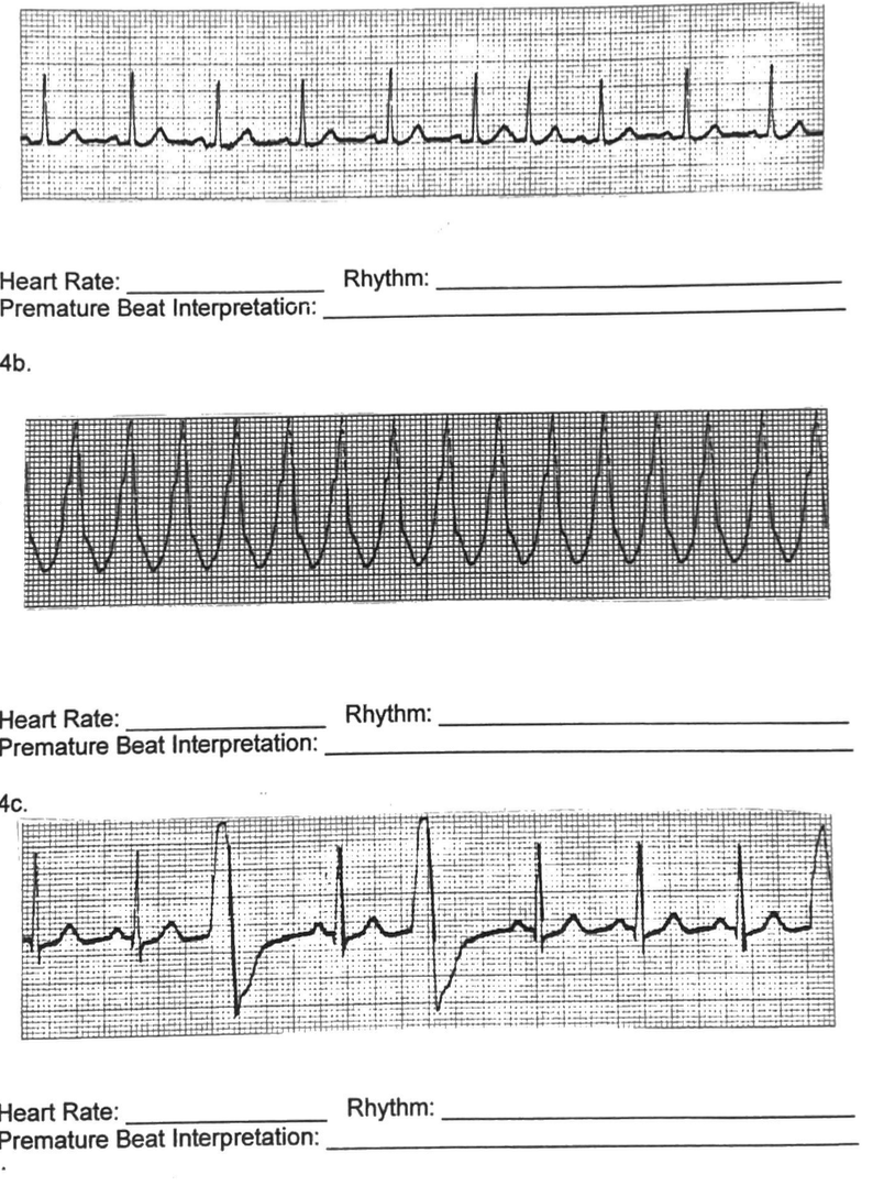 Solved for each of them, find the heart rate, rhythm, and | Chegg.com