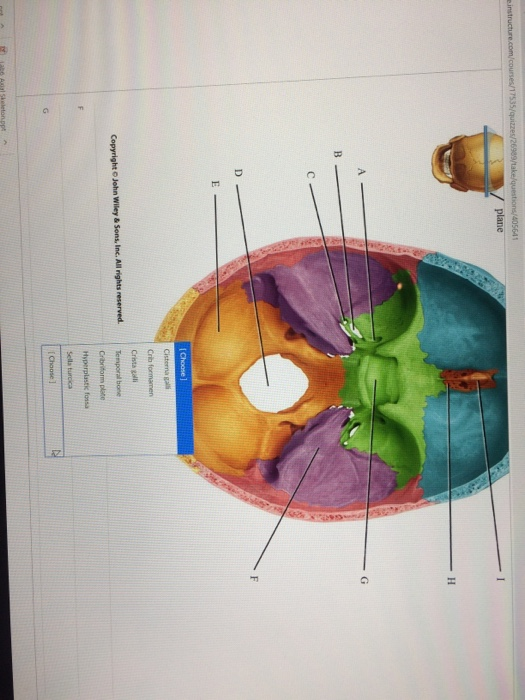 Solved plane Crib formamen Crista gali Temporal bone | Chegg.com