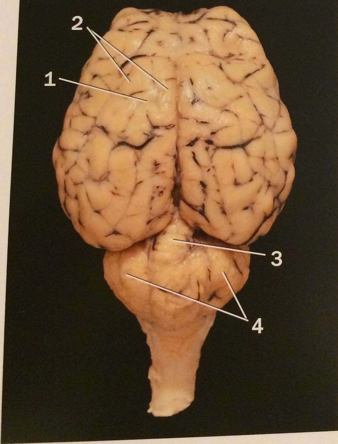 tentorium cerebelli sheep brain