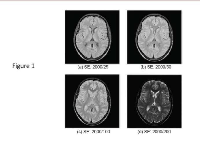 = 5. Assume an MRI spin-echo (SE) sequence with Be | Chegg.com