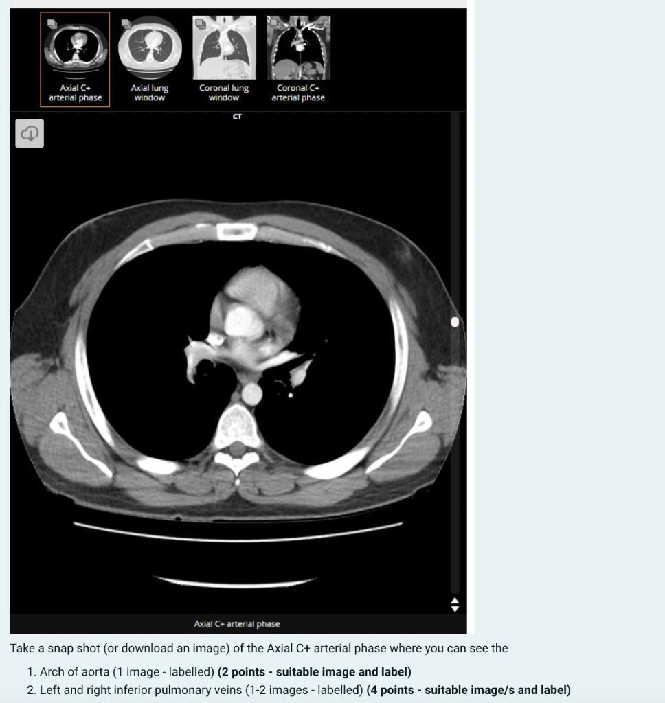 Solved Several respiratory conditions can impact gas | Chegg.com