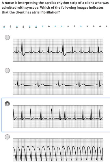 Solved A Nurse Is Interpreting The Cardiac Rhythm Strip O Chegg Com
