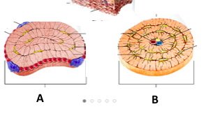 Which Cross Section Is Spongy Bone And Which Cross Chegg Com