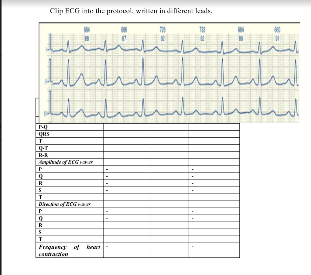 Solved Clip ECG into the protocol, written in different | Chegg.com