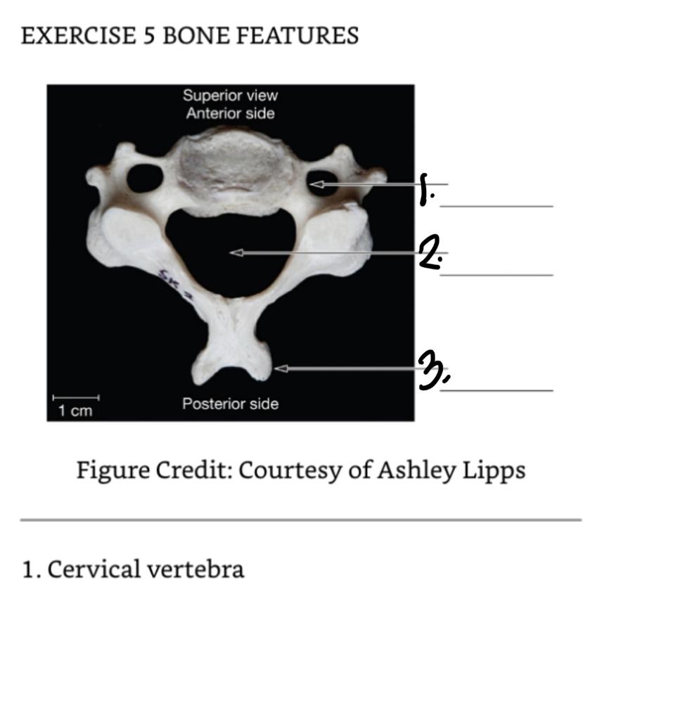 CrossFit  The Cervical Vertebrae