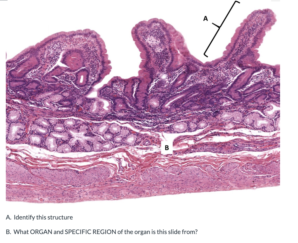 Solved A. Identify this structure B. What ORGAN and SPECIFIC | Chegg.com