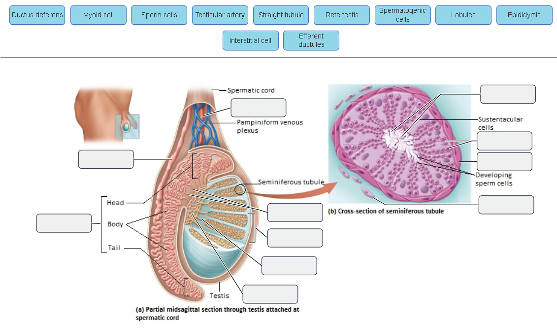 Solved Ductus deferens Myoid cell Head Body Tail Sperm cells | Chegg.com