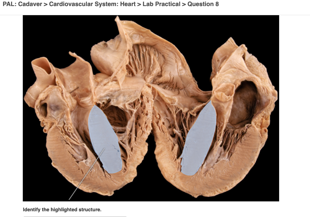 Solved PAL Cadaver > Cardiovascular System Heart >