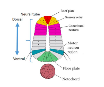 Solved The notochord is a temporary structure of mesodermal 