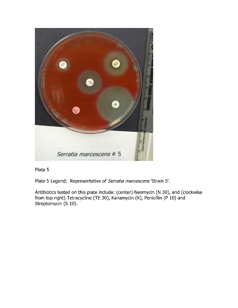 Solved Kirby-Bauer Antimicrobial Susceptibility Test ****USE | Chegg.com