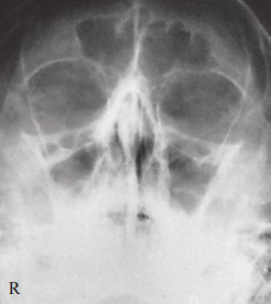 Solved do image critique using PACEMAN guideline for the | Chegg.com