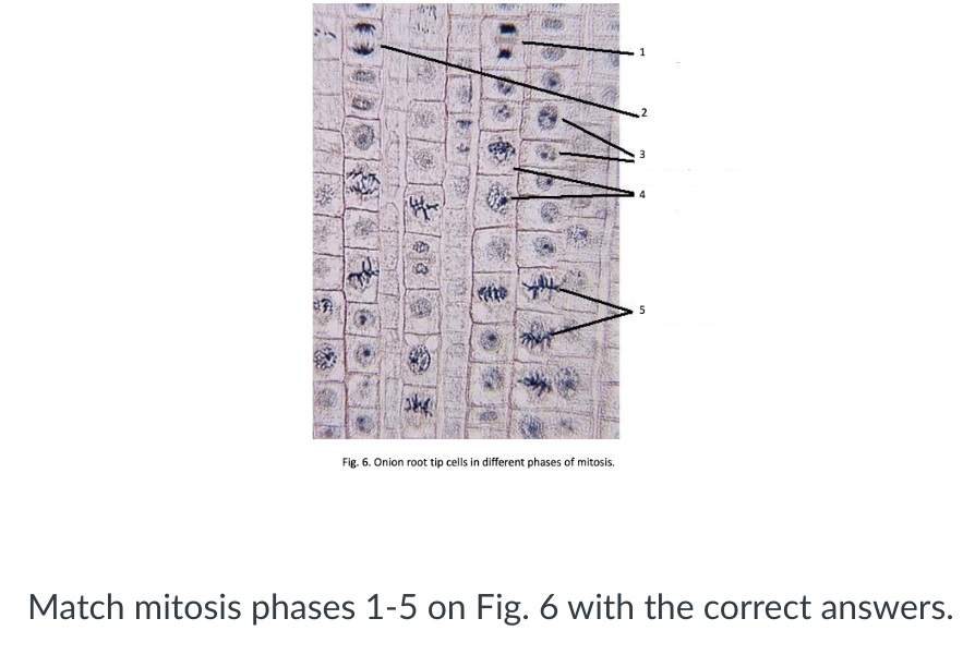 Solved Answer choices are as follows Metaphase | Chegg.com