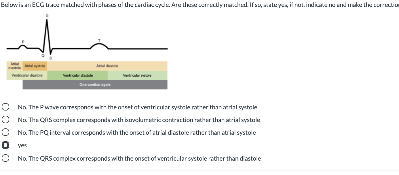 Solved Below is an ECG trace matched with phases of the | Chegg.com