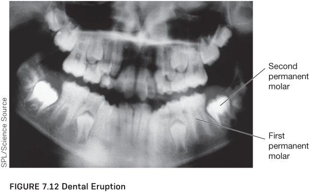 Solved Examine the X-ray of a juvenile upper and lower | Chegg.com