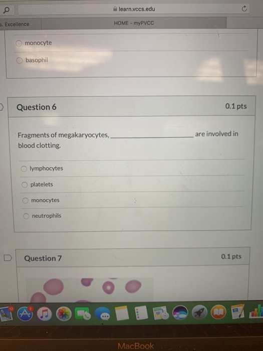 Solved Question 1 0.1pts Blood is composed of % red blood | Chegg.com